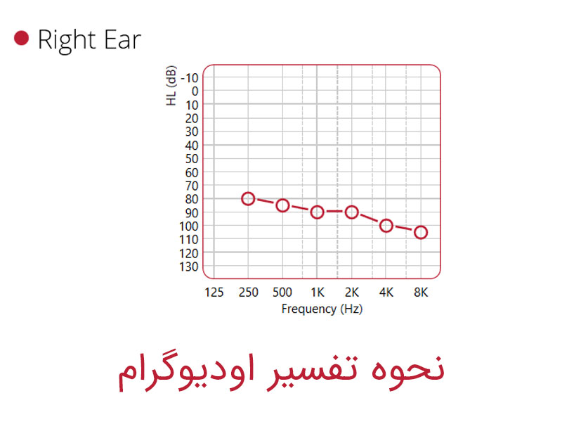568 خدمات تفسیر نوار گوش در اصفهان 568 • خدمات تفسیر نوار گوش در اصفهان
