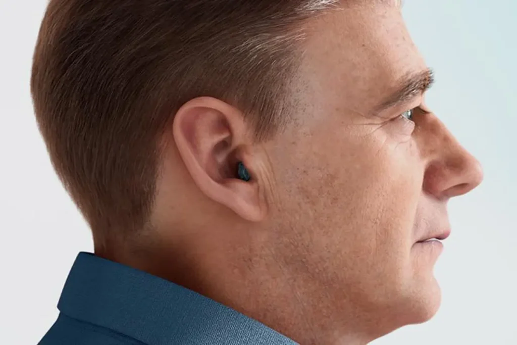 Smallest Hearing Aid کوچکترین سمعک : راهنمای جامع انتخاب و خرید سمعکهای نامرئی مزایای کوچکترین سمعک