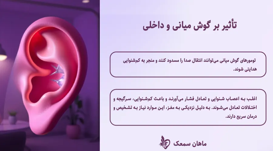 تومور گوش می تواند در قسمت گوش میانی یا داخلی ایجاد گردد